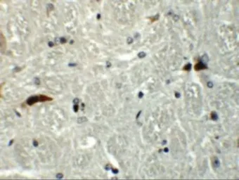 Anti-Rabex5 antibody used in IHC (Paraffin sections) (IHC-P). GTX32007