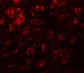 Anti-Rabex5 antibody used in IHC (Paraffin sections) (IHC-P). GTX32007