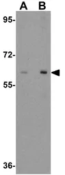 Anti-Rabex5 antibody used in Western Blot (WB). GTX32007
