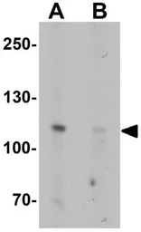 Anti-ATP2C2 antibody used in Western Blot (WB). GTX32009