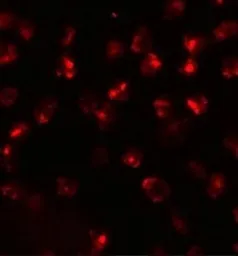 Anti-ATP2C2 antibody used in Immunocytochemistry/ Immunofluorescence (ICC/IF). GTX32009