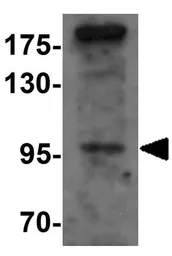 Anti-SIK2 antibody used in Western Blot (WB). GTX32010
