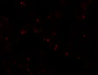 Anti-SIK2 antibody used in Immunocytochemistry/ Immunofluorescence (ICC/IF). GTX32010