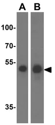 Anti-SPTLC1 antibody used in Western Blot (WB). GTX32011