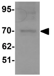 Anti-KAL1 antibody used in Western Blot (WB). GTX32013