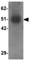 Anti-RASSF10 antibody used in Western Blot (WB). GTX32014
