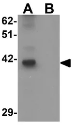 Anti-TRMT12 antibody used in Western Blot (WB). GTX32015