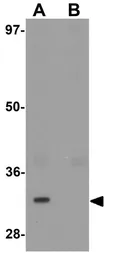 Anti-TYW3 antibody used in Western Blot (WB). GTX32016