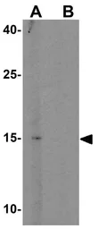 Anti-MEIG1 antibody used in Western Blot (WB). GTX32017