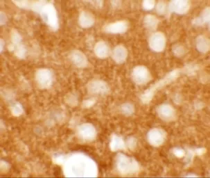 Anti-TMEM88 antibody used in IHC (Paraffin sections) (IHC-P). GTX32020