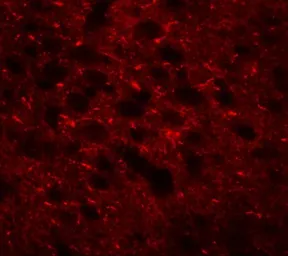 Anti-TMEM88 antibody used in IHC (Paraffin sections) (IHC-P). GTX32020