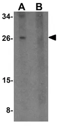 Anti-TMEM88 antibody used in Western Blot (WB). GTX32020