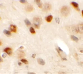 Anti-CMYA5 antibody used in IHC (Paraffin sections) (IHC-P). GTX32021