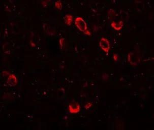 Anti-CMYA5 antibody used in IHC (Paraffin sections) (IHC-P). GTX32021