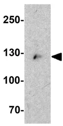 Anti-CMYA5 antibody used in Western Blot (WB). GTX32021