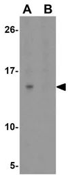 Anti-SPRYD4 antibody used in Western Blot (WB). GTX32023