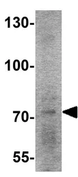 Anti-HDGFRP2 antibody used in Western Blot (WB). GTX32024