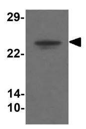 Anti-TMEM204 antibody used in Western Blot (WB). GTX32025