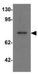 Anti-PALM3 antibody used in Western Blot (WB). GTX32027
