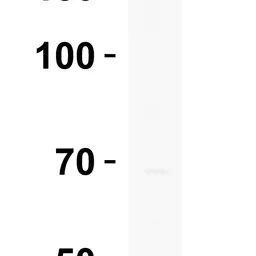 Anti-UHRF1BP1 antibody used in Western Blot (WB). GTX32029