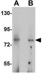 Anti-UHRF1BP1 antibody used in Western Blot (WB). GTX32029