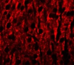 Anti-RILPL1 antibody used in IHC (Paraffin sections) (IHC-P). GTX32031