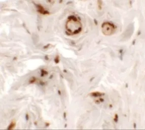 Anti-UPK1B antibody used in IHC (Paraffin sections) (IHC-P). GTX32032