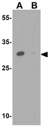 Anti-UPK1B antibody used in Western Blot (WB). GTX32032