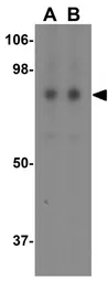 Anti-FCHSD1 antibody used in Western Blot (WB). GTX32034