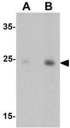 Anti-DRGX antibody used in Western Blot (WB). GTX32035