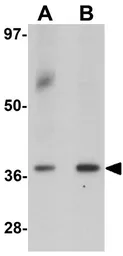 Anti-SPATA1 antibody used in Western Blot (WB). GTX32038