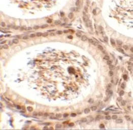 Anti-SPATA3 antibody used in IHC (Paraffin sections) (IHC-P). GTX32039