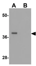 Anti-PRICKLE4 antibody used in Western Blot (WB). GTX32042