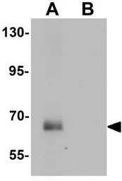 Anti-SPATA18 antibody used in Western Blot (WB). GTX32044