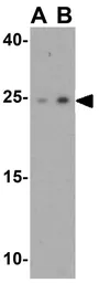 Anti-SPATA19 antibody used in Western Blot (WB). GTX32045