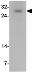 Anti-SIVA antibody used in Western Blot (WB). GTX32046