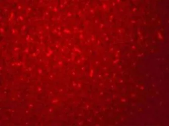 Anti-SIVA antibody used in IHC (Paraffin sections) (IHC-P). GTX32046
