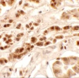 Anti-PTCHD2 antibody used in IHC (Paraffin sections) (IHC-P). GTX32048