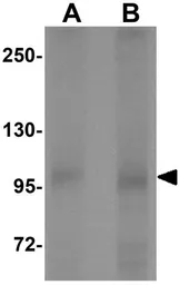 Anti-PTCHD2 antibody used in Western Blot (WB). GTX32048
