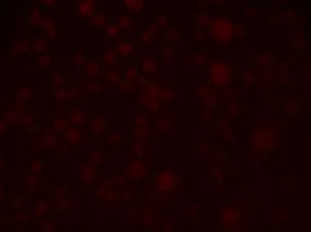 Anti-SLAIN1 antibody used in Immunocytochemistry/ Immunofluorescence (ICC/IF). GTX32052