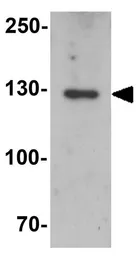 Anti-MYBPC1 antibody used in Western Blot (WB). GTX32053