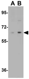 Anti-IRF2BP2 antibody used in Western Blot (WB). GTX32054