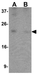 Anti-B9D1 antibody used in Western Blot (WB). GTX32055