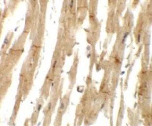 Anti-MLIP antibody used in IHC (Paraffin sections) (IHC-P). GTX32056