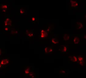 Anti-Nkx2.4 antibody used in Immunocytochemistry/ Immunofluorescence (ICC/IF). GTX32058