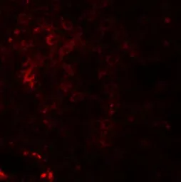 Anti-Nkx2.6 antibody used in IHC (Paraffin sections) (IHC-P). GTX32059