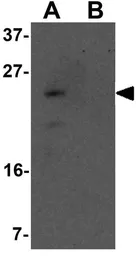 Anti-YPEL1 antibody used in Western Blot (WB). GTX32062
