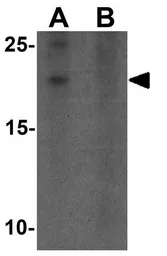Anti-YPEL3 antibody used in Western Blot (WB). GTX32064