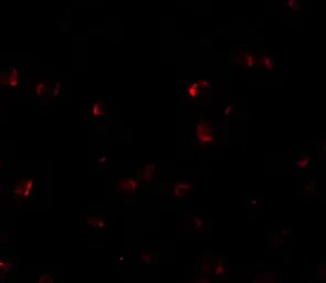 Anti-YPEL3 antibody used in Immunocytochemistry/ Immunofluorescence (ICC/IF). GTX32064
