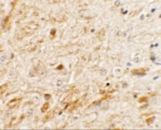 Anti-TMEM106A antibody used in IHC (Paraffin sections) (IHC-P). GTX32066